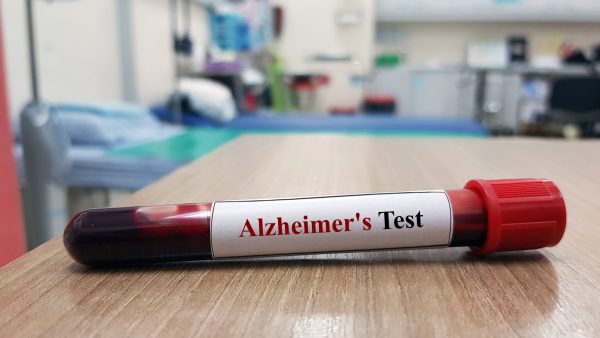 Alzheimer's blood Test